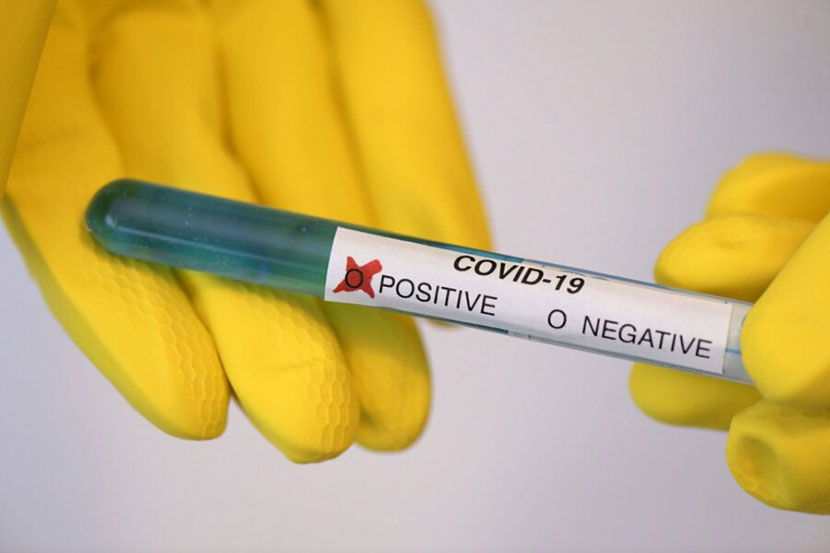 За сутки в Эстонии выявлено еще 36 зараженных коронавирусом, почти половина из них на Сааремаа. В больнице 56 человек