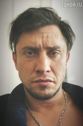 Прилучный шокировал фанатов постаревшим и изможденным видом