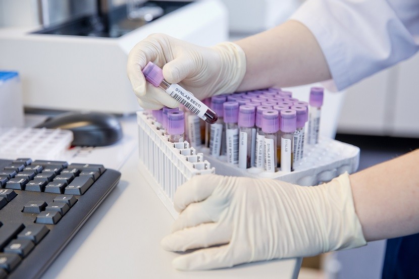 SYNLAB обновила методику анализов на антитела против коронавируса