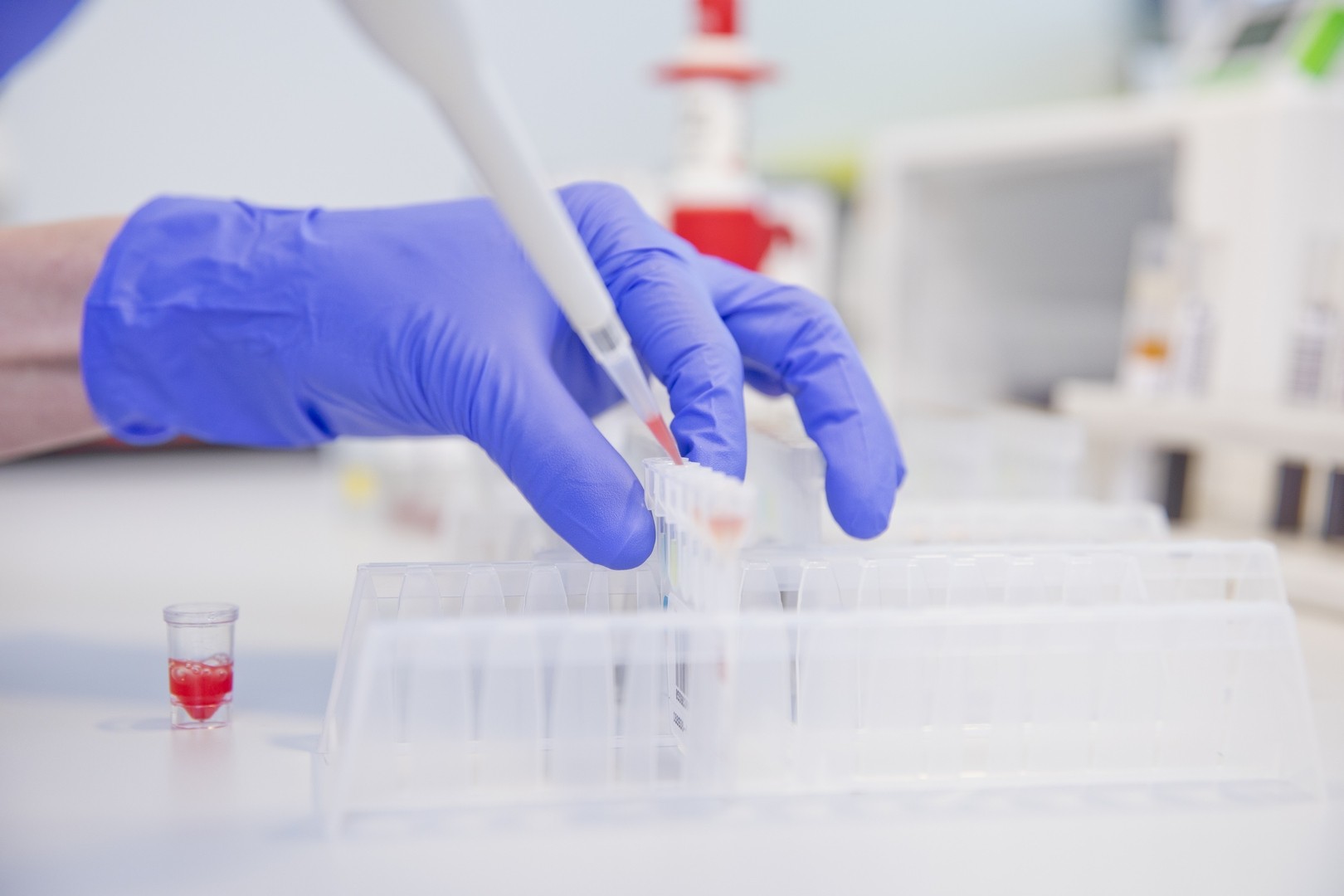 SYNLAB начнет проводить тестирование на коронавирус по новой методике